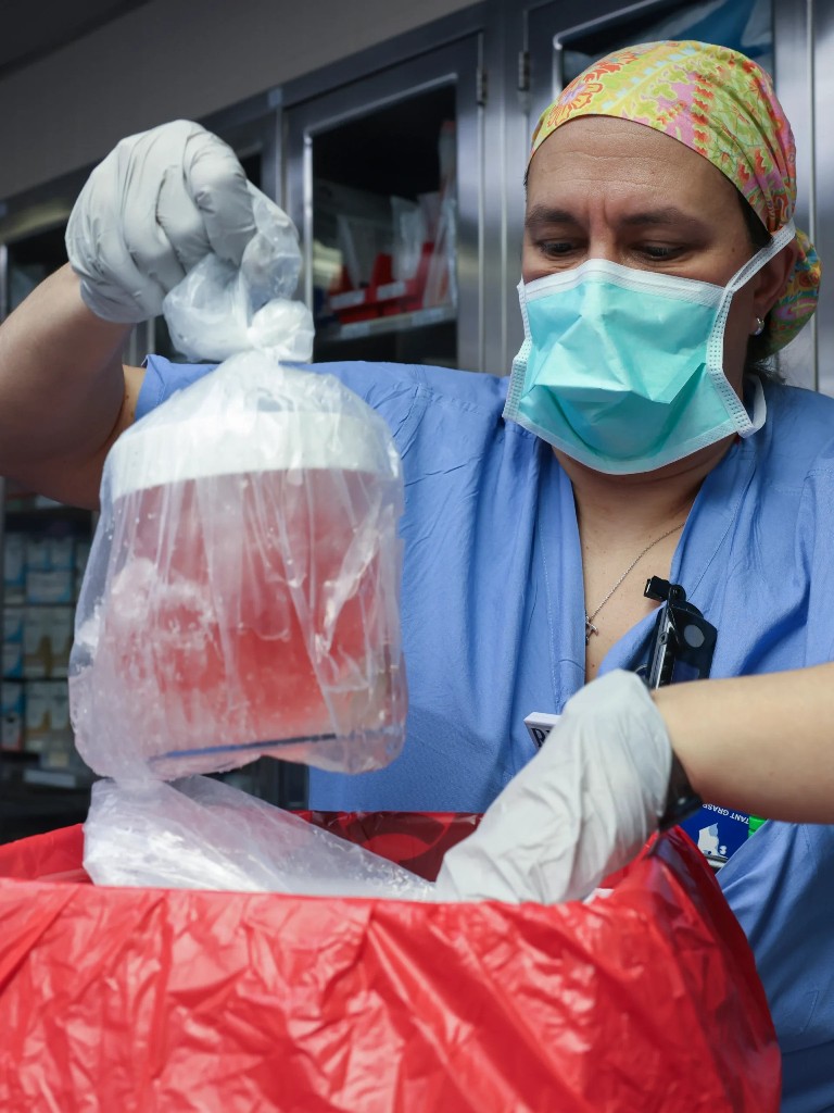 Man gets Pig kidney transplant in US Hosptals